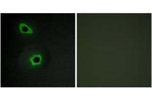 Immunofluorescence analysis of COS7 cells, using Collagen VII alpha1 Antibody.