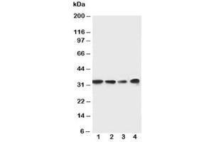 Western blot testing of MyD88 antibody and Lane 1:  rat spleen (MYD88 Antikörper  (Middle Region))