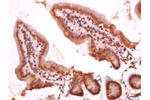 Paraformaldehyde-fixed, paraffin embedded mouse intestine, Antigen retrieval by boiling in sodium citrate buffer (pH6) for 15min, Block endogenous peroxidase by 3% hydrogen peroxide for 30 minutes, Blocking buffer (normal goat serum) at 37°C for 20min, Antibody incubation with Rabbit Anti-APOC3 Polyclonal Antibody, Unconjugated  at 1:200 overnight at 4°C, followed by a conjugated secondary for 90 minutes and DAB staining. (APOC3 Antikörper  (AA 41-80))