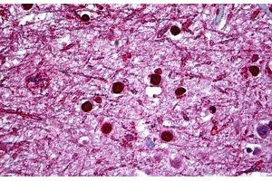 Human Brain, Cortex: Formalin-Fixed, Paraffin-Embedded (FFPE) (HMX2 Antikörper  (AA 125-224))