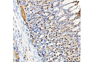 IHC analysis of SP6 using anti-SP6 antibody (ABIN5692945).