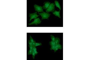 ICC/IF analysis of EPHA2 in HeLa cell line, stained monoclonal anti-human EPHA2 antibody (1:100) with goat anti-mouse IgG-Alexa fluor 488 conjugate (Green). (EPH Receptor A2 Antikörper  (AA 27-537))