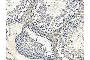 ABIN7096731 and ABIN7100796 at 1/100 staining rat testis tissue by IHC-P.