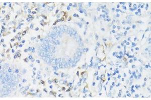 Immunohistochemistry of paraffin-embedded Human appendix using CD11A Polyclonal Antibody at dilution of 1:100 (40x lens). (ITGAL Antikörper)