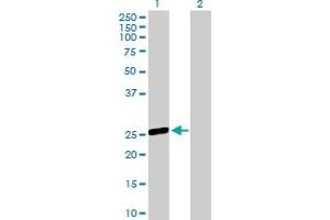 Western Blot analysis of OSTF1 expression in transfected 293T cell line by OSTF1 MaxPab polyclonal antibody. (OSTF1 Antikörper  (AA 1-217))