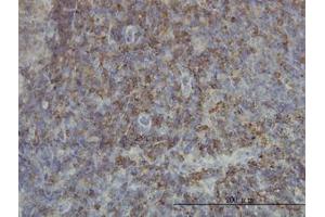 Image no. 1 for anti-SH2 Domain Containing 3C (SH2D3C) (AA 1-111) antibody (ABIN599111) (SH2D3C Antikörper  (AA 1-111))