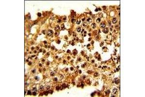 Formalin-fixed and paraffin-embedded human testis tissue with PTTG1 Antibody (N-term), which was peroxidase-conjugated to the secondary antibody, followed by DAB staining. (PTTG1 Antikörper  (N-Term))