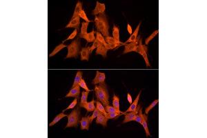 Immunofluorescence analysis of NIH/3T3 cells using PSMC5 Rabbit mAb (ABIN7269585) at dilution of 1:50 (40x lens). (PSMC5 Antikörper)
