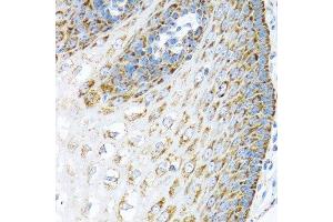 Immunohistochemistry (Paraffin-embedded Sections) (IHC (p)) image for anti-Leucine-Rich PPR-Motif Containing (LRPPRC) (AA 1041-1394) antibody (ABIN1680717)