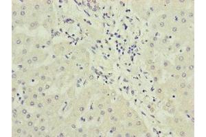 Immunohistochemistry (IHC) image for anti-Protein Phosphatase 2A 48 KDa Regulatory Subunit (PPP2R3B) (AA 356-575), (Regulatory Subunit B) antibody (ABIN7169283)