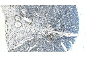 IHC analysis of H Cadherin/CDH13 using anti-H Cadherin/CDH13 antibody (ABIN7600095). (Cadherin 13 Antikörper  (AA 149-692))