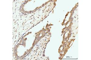 IHC analysis of Golgin 97/GOLGA1 using anti-Golgin 97/GOLGA1 antibody (ABIN7599539). (GOLGA1 Antikörper  (AA 1-752))