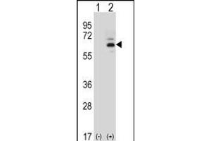 Western blot analysis of FASTK (arrow) using rabbit polyclonal FASTK Antibody (C-term) (ABIN656397 and ABIN2845692). (FASTK Antikörper  (C-Term))