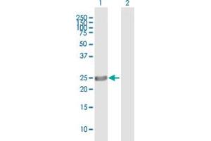 Western Blot analysis of ASPH expression in transfected 293T cell line by ASPH MaxPab polyclonal antibody. (Aspartate beta Hydroxylase Antikörper  (AA 1-210))