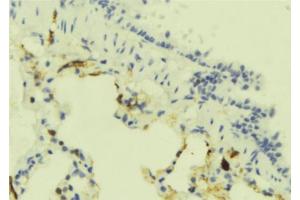 ABIN6273906 at 1/100 staining Mouse lung tissue by IHC-P. (GPR183 Antikörper  (Internal Region))