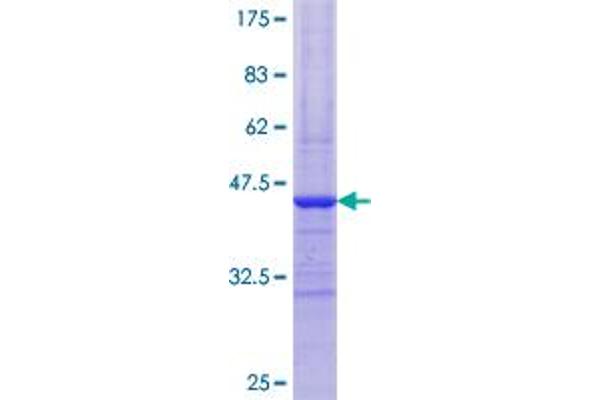 PYGM Protein (AA 734-842) (GST tag)