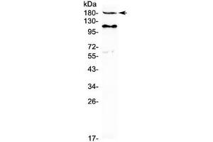 Western blot testing of human MCF7 cell lysate with VEGFR2 antibody at 0.