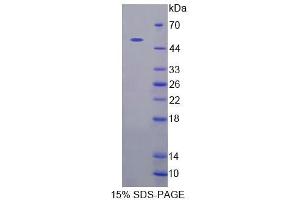 SDS-PAGE analysis of Human CADPS Protein. (CADPS Protein)