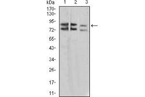 Western Blotting (WB) image for anti-Interleukin 1 Receptor Accessory Protein-Like 1 (IL1RAPL1) (AA 541-694) antibody (ABIN5925590) (IL1RAPL1 Antikörper  (AA 541-694))