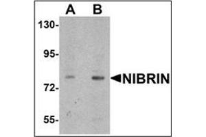 Western blot analysis of NIBRIN in rat lung tissue lysate with NIBRIN antibody (N-term) Cat. (Nibrin Antikörper  (N-Term))