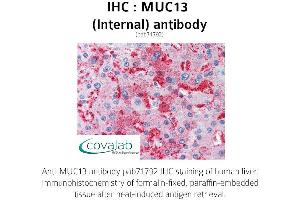 Image no. 2 for anti-Mucin 13, Cell Surface Associated (MUC13) (Internal Region) antibody (ABIN1737140)