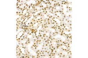 Immunohistochemistry of paraffin embedded mouse kidney using HIF-3α (ABIN7074273) at dilution of 1:1600 (400x lens) (HIF3A Antikörper)