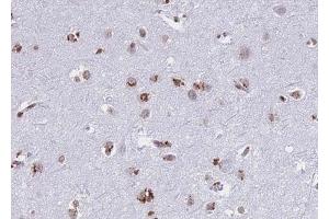 ABIN6268739 at 1/100 staining human brain tissue sections by IHC-P. (Cathepsin D Antikörper  (C-Term))