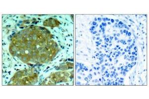 Immunohistochemistry (IHC) image for anti-Nuclear Factor of kappa Light Polypeptide Gene Enhancer in B-Cells 1 (NFKB1) (pSer932) antibody (ABIN7138734)