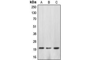 Western blot analysis of Caspase 4 p20 expression in HepG2 colchicine-treated (A), SP2/0 H2O2-treated (B), rat kidney (C) whole cell lysates. (Caspase 4 p20 (Center) Antikörper)