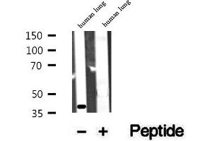 Western blot analysis of extracts of human lung tissue, using ACAA1 antibody. (ACAA1 Antikörper  (N-Term))