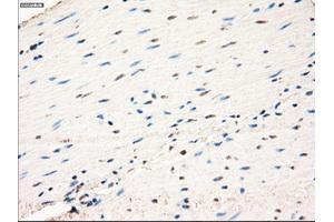 Immunohistochemical staining of paraffin-embedded prostate tissue using anti-MAP2K1 mouse monoclonal antibody. (MEK1 Antikörper)