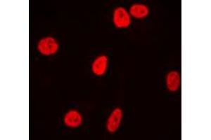 Immunofluorescent analysis of Ku80 staining in HeLa cells. (XRCC5 Antikörper  (C-Term))