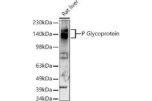 Western blot analysis of extracts of Rat liver, using P Glycoprotein antibody (ABIN7265732) at 1:500 dilution. (ABCB1 Antikörper)