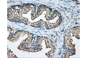 Immunohistochemical staining of paraffin-embedded pancreas tissue using anti-CAPZA1 mouse monoclonal antibody. (CAPZA1 Antikörper)