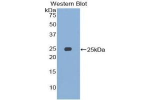 Detection of Recombinant SMC3, Human using Polyclonal Antibody to Structural Maintenance Of Chromosomes Protein 3 (SMC3) (SMC3 Antikörper  (AA 994-1181))