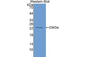 Western Blotting (WB) image for anti-Fast Skeletal Troponin I (TNNI2) (AA 1-182) antibody (ABIN1078623) (TNNI2 Antikörper  (AA 1-182))