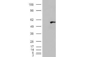 Western Blotting (WB) image for anti-WAS/WASL Interacting Protein Family, Member 1 (WIPF1) antibody (ABIN5906335) (WIPF1 Antikörper)