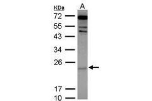 Image no. 2 for anti-Cytoglobin (CYGB) (AA 1-190) antibody (ABIN1501883) (CYGB Antikörper  (AA 1-190))