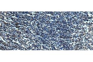 Immunohistochemistry of paraffin-embedded Human tonsil tissue using SLC2A12 Polyclonal Antibody at dilution of 1:30(x200) (GLUT12 Antikörper)