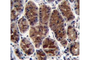 CTGF antibody immunohistochemistry analysis in formalin fixed and paraffin embedded human stomach tissue. (CTGF Antikörper  (AA 134-159))