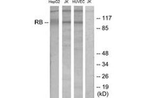 Western blot analysis of extracts from HepG2/Jurkat/HuvEc cells, using Retinoblastoma (Ab-780) Antibody. (Retinoblastoma Protein (Rb) Antikörper  (AA 751-800))
