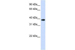 GPD1L antibody used at 1 ug/ml to detect target protein.