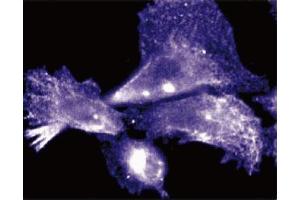 Immunofluorescent staining of Human Endothelial cells. (Cyclin D3 Antikörper  (AA 127-292))