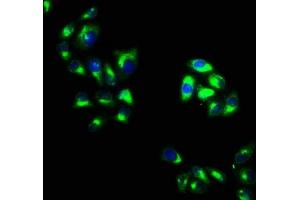 Immunofluorescence staining of Hela cells with ABIN7162326 at 1:100, counter-stained with DAPI. (Otogelin (OTOG) (AA 1634-1796) Antikörper)