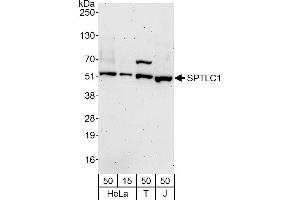 anti-serine Palmitoyltransferase, Long Chain Base Subunit 1 (SPTLC1) (AA 423-473) antibody