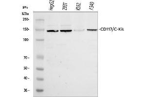 Western blot analysis of Kit using anti-Kit antibody (ABIN7825521).