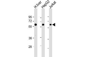 All lanes : Anti-CYP2E1 Antibody (Center) at 1:4000 dilution Lane 1: human liver lysate Lane 2: HepG2 whole cell lysate Lane 3: Jurkat whole cell lysate Lysates/proteins at 20 μg per lane. (CYP2E1 Antikörper  (AA 166-198))