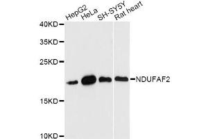 Western blot analysis of extracts of various cell lines, using NDUFAF2 antibody. (NDUFAF2 Antikörper)