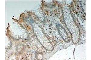 Image no. 1 for anti-Interleukin 12 beta (IL12B) (Internal Region) antibody (ABIN374765) (IL12B Antikörper  (Internal Region))