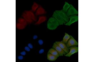 ABIN6257896 and ABIN6274807 staining Hela cells by IF/ICC. (ACOT8 Antikörper  (Internal Region))